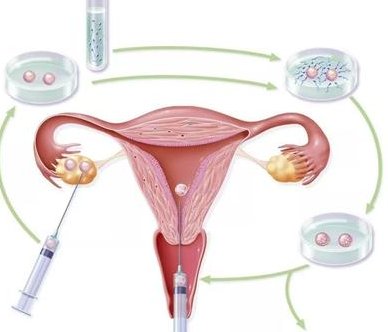 分享：泰国试管婴儿收费价目表以及省钱攻略