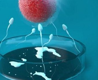 第三代试管PGD和PGS这两种筛查结果哪个更严格？